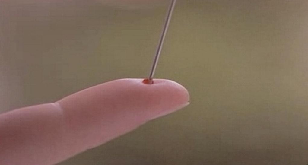 Comment sauver quelqu'un d'un AVC avec juste une aiguille ? - NewsMAG