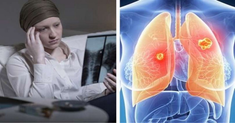 Comment Se Passe Une Radio Des Poumons Pour Une Femme