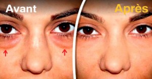 Les 5 meilleurs remèdes pour atténuer les poches sous les yeux - NewsMAG