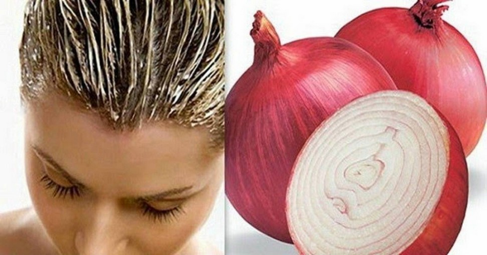 Remède naturel anti chute de cheveux  NewsMAG