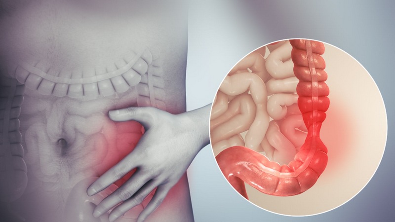 6 remèdes naturels qui soulagent syndrome du côlon irritable