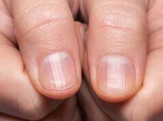 Est-il possible de remédier aux stries sur mes ongles ? Quelles en sont les causes ? Est-il possible de remédier aux stries sur mes ongles ? Quelles en sont les causes ?